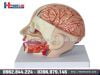 Mô Hình Giải Phẫu Đầu Não Bóc Tách